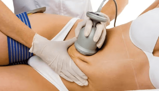 Paquete reductor personalizado